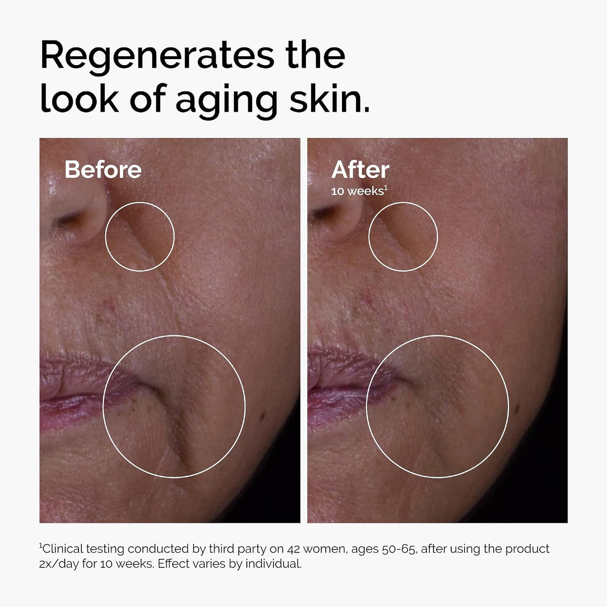 The Ordinary GF 15% Solution, fórmula antienvejecimiento para repar...