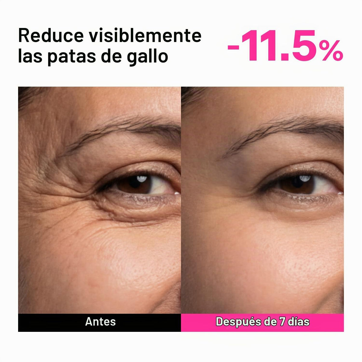 Colágeno, péptido y suero retiniano para líneas finas y arrugas (pa...
