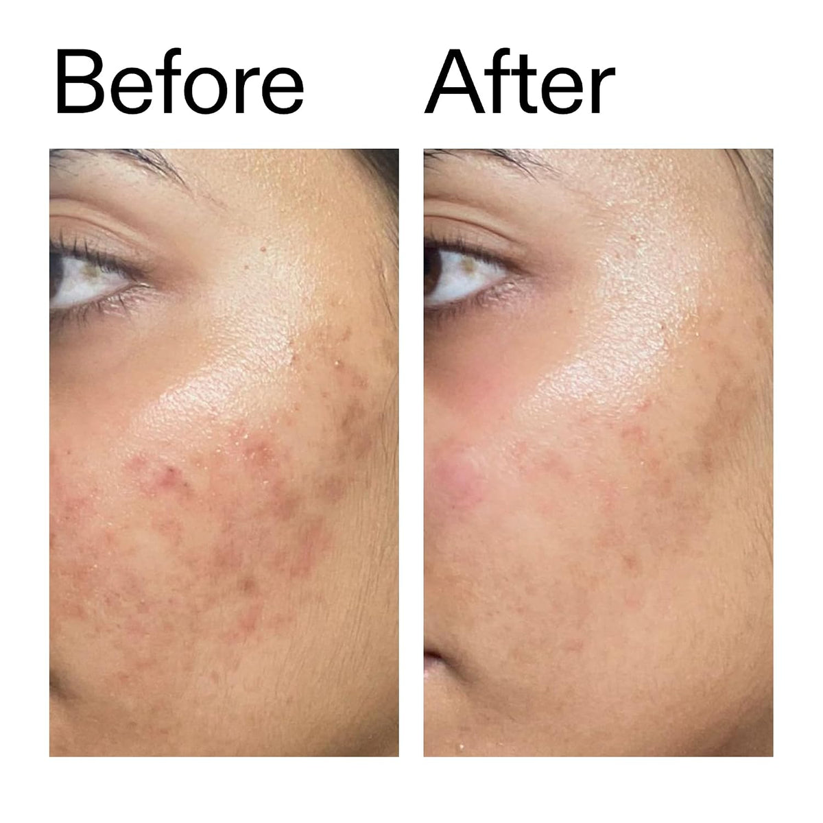 The INKEY List Ectoin Hydro-Barrier Serum, suero avanzado de doble...