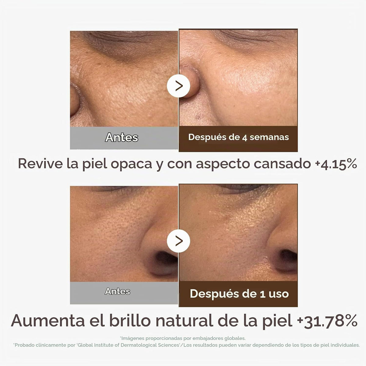medicube Suero de cápsulas de vitamina C profunda, 1.01 onzas líqui...
