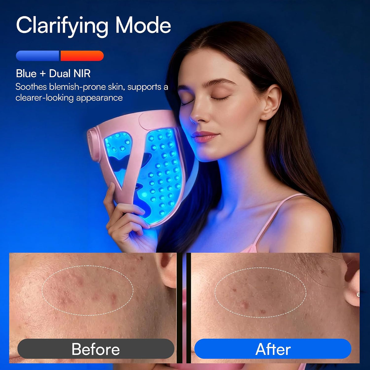 INIA Glow 4D Máscara inalámbrica de terapia de luz roja para cara,...