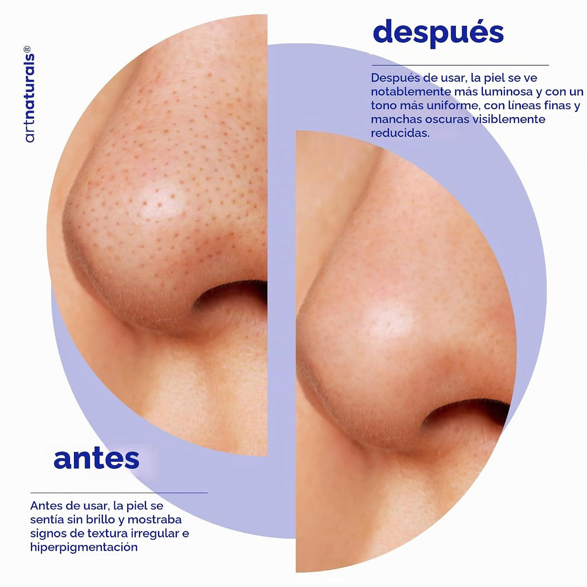 ArtNaturals - Suero facial de ácido glicólico, vitamina C y aloe ve...