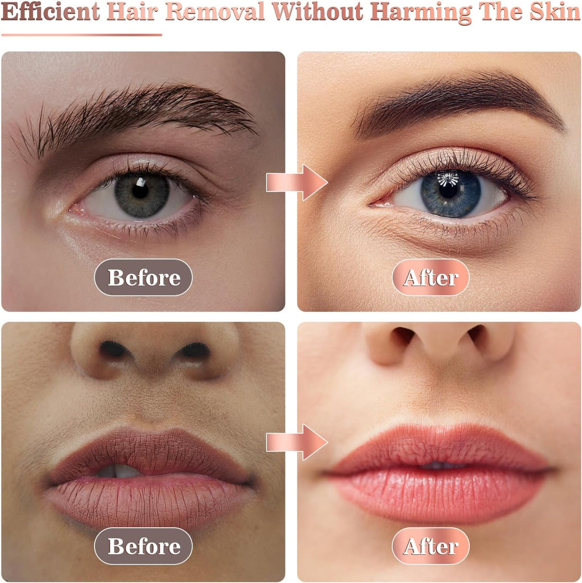 Vexloria Removedor de vello facial para mujeres, recargable por USB...