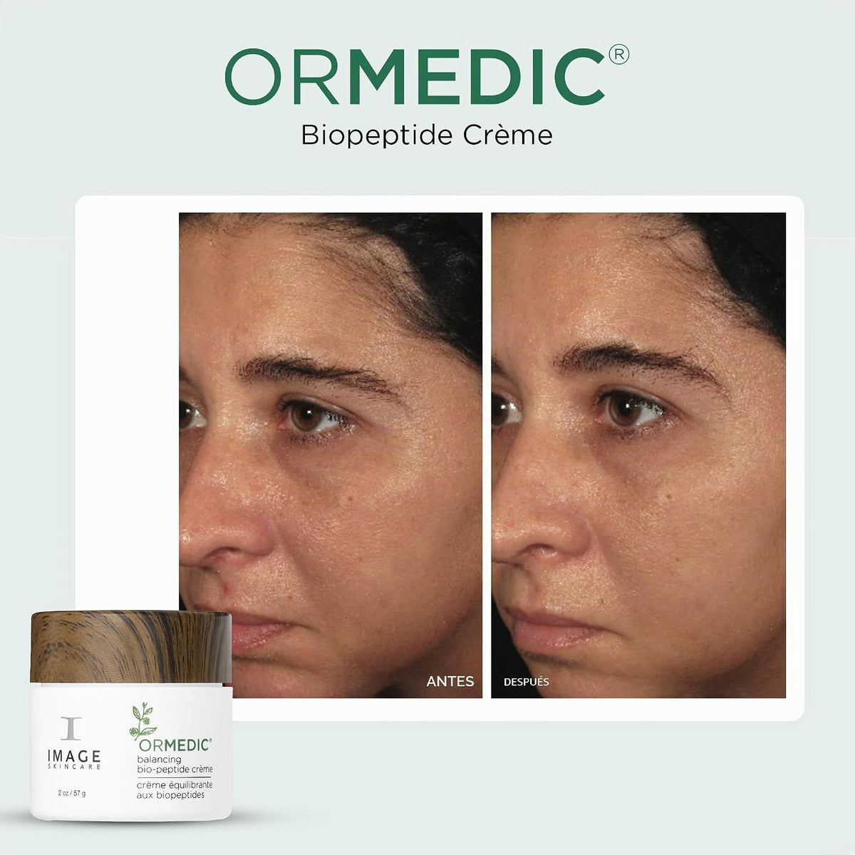 IMAGE Skincare ORMEDIC Biopeptide Crème, 2oz - Hidratante facial |...