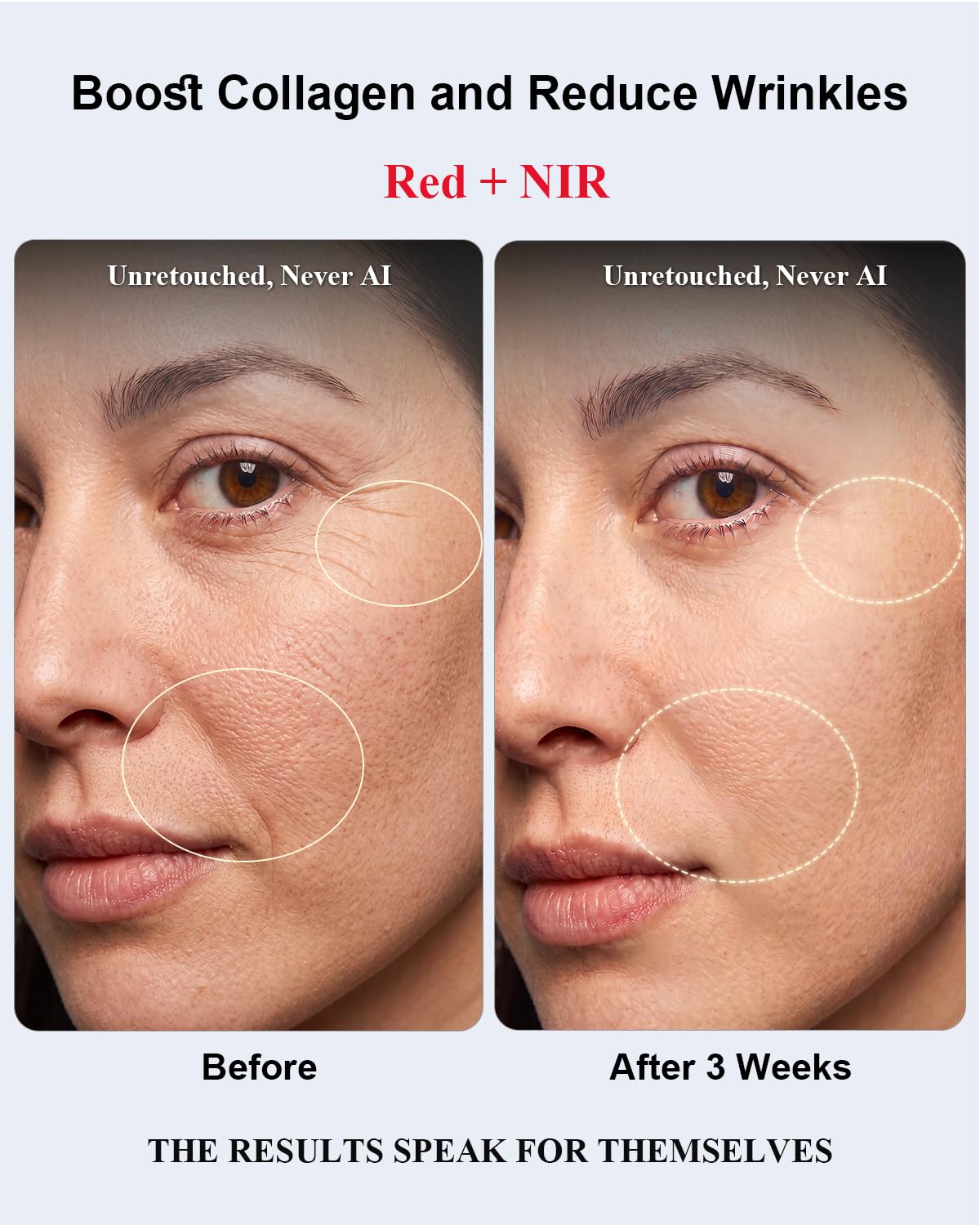Terapia de luz roja para cara, clínicamente respaldada y aprobada p...