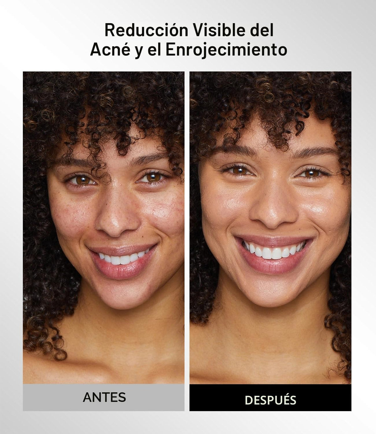 INIA Máscara inalámbrica de terapia de luz roja GLOW para cara, 850...