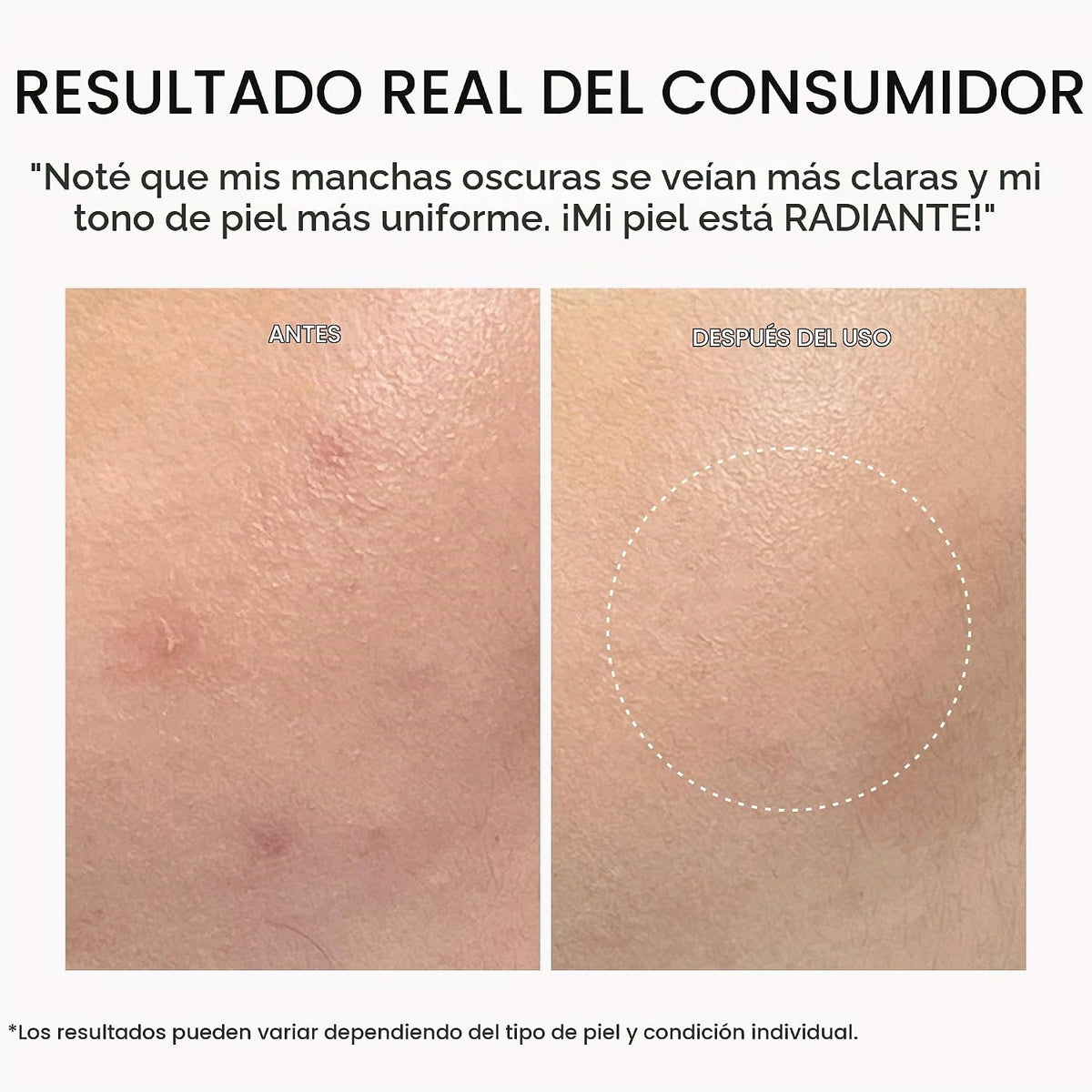 Arencia TXA Booster Shot Serum con 5% de ácido tranexámico y péptid...