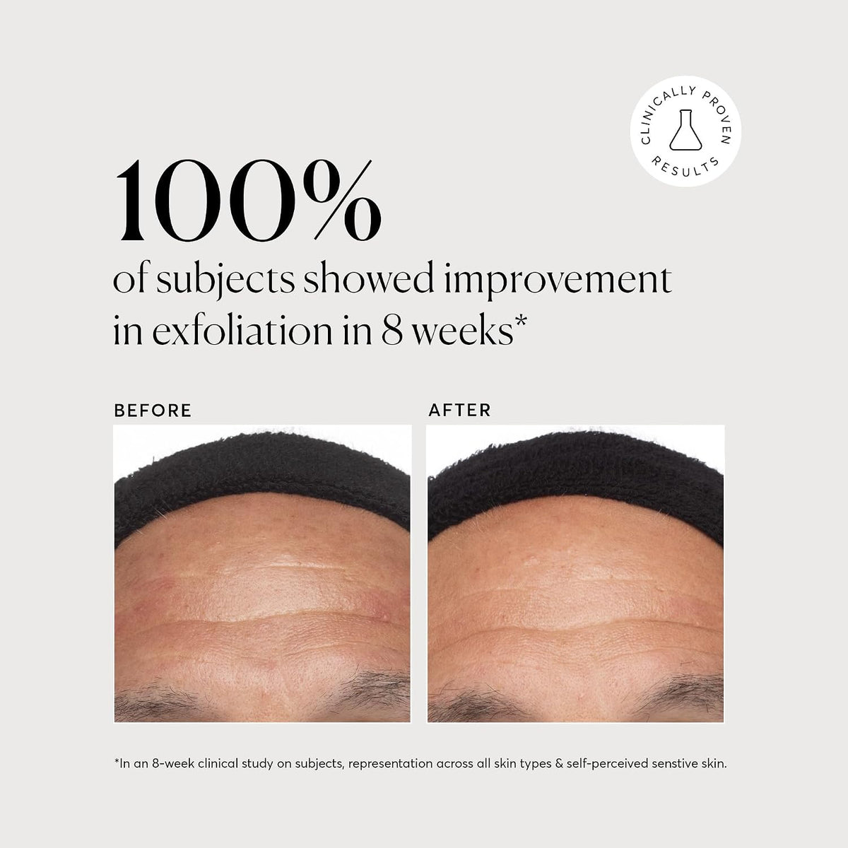 Naturium Ácido Azelaico Tópico 10%, tratamiento de belleza para el...