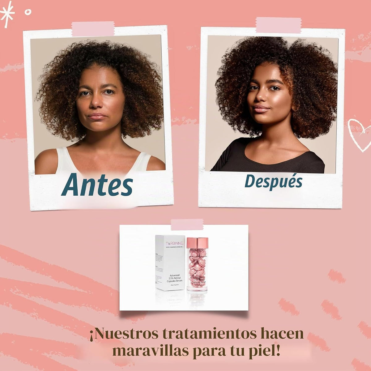 TURBINNE Cápsulas de suero de retinol puro al 2.5%. Luce 5 años más...