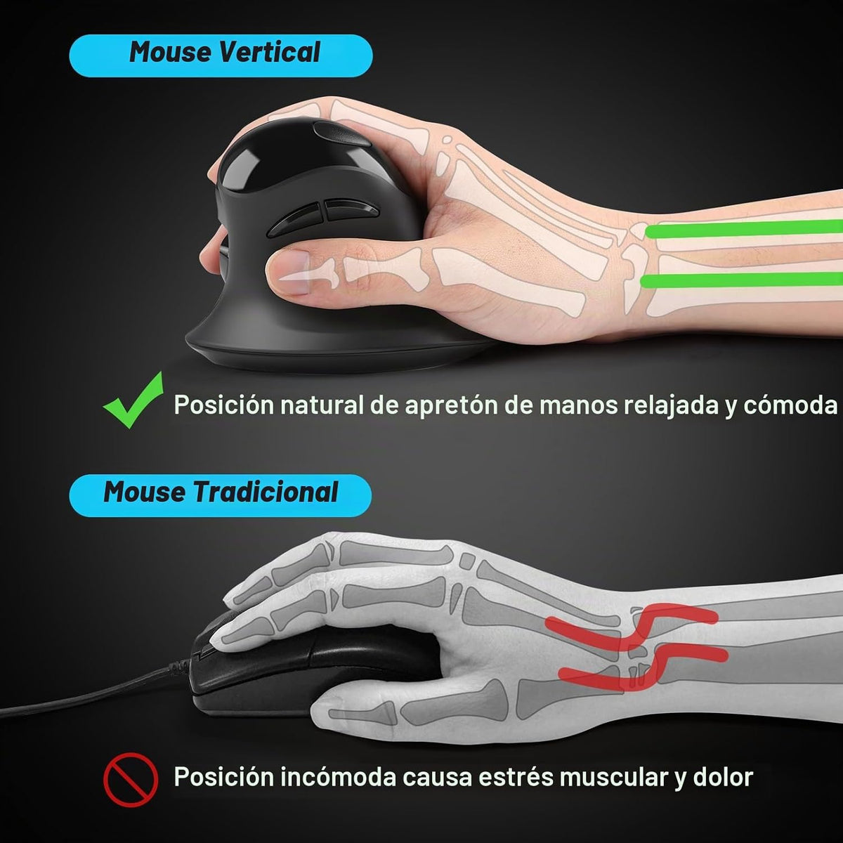 MicroPack Ratón ergonómico, ratón inalámbrico vertical con USB A y...