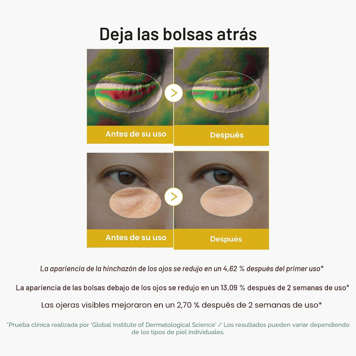 medicube Eye Jelly Serum &amp; Cream Duo - Gel de ojos de ácido kój...