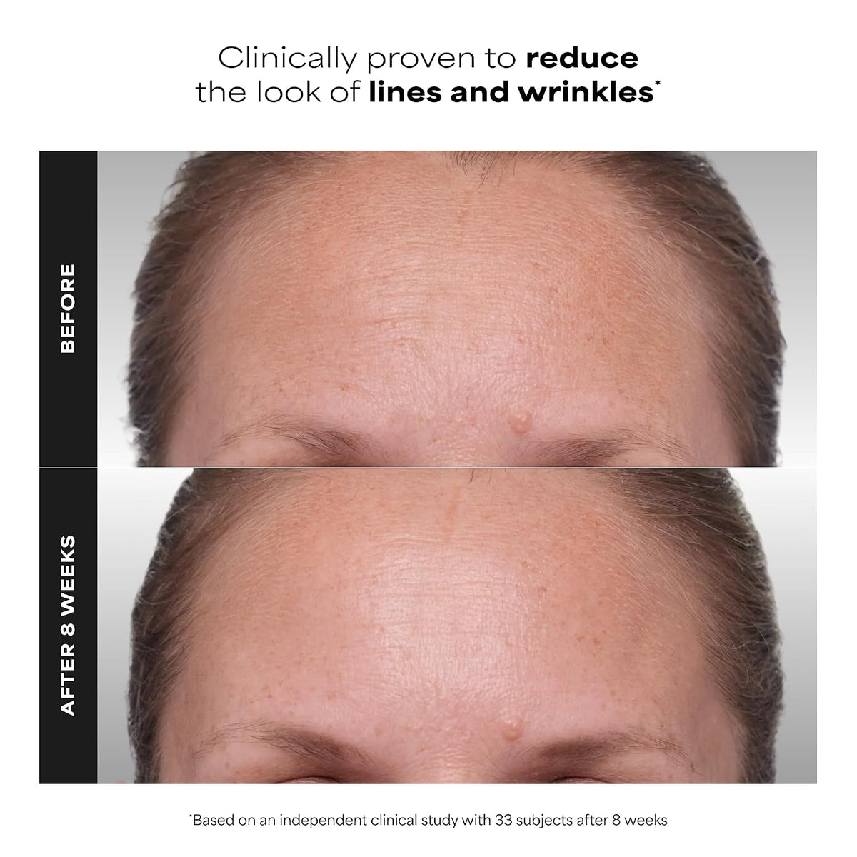 Paula's Choice CLÍNICA 1% Retinol Crema Tratamiento | Suero facial...