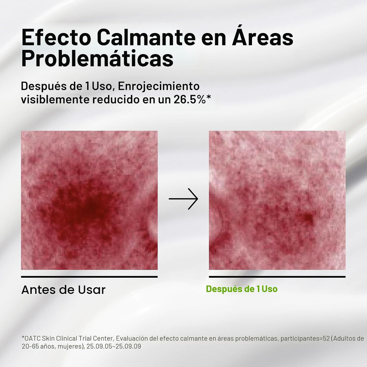 ANUA Hidratante calmante para la piel con ácido azelaico CICA, 3.38...