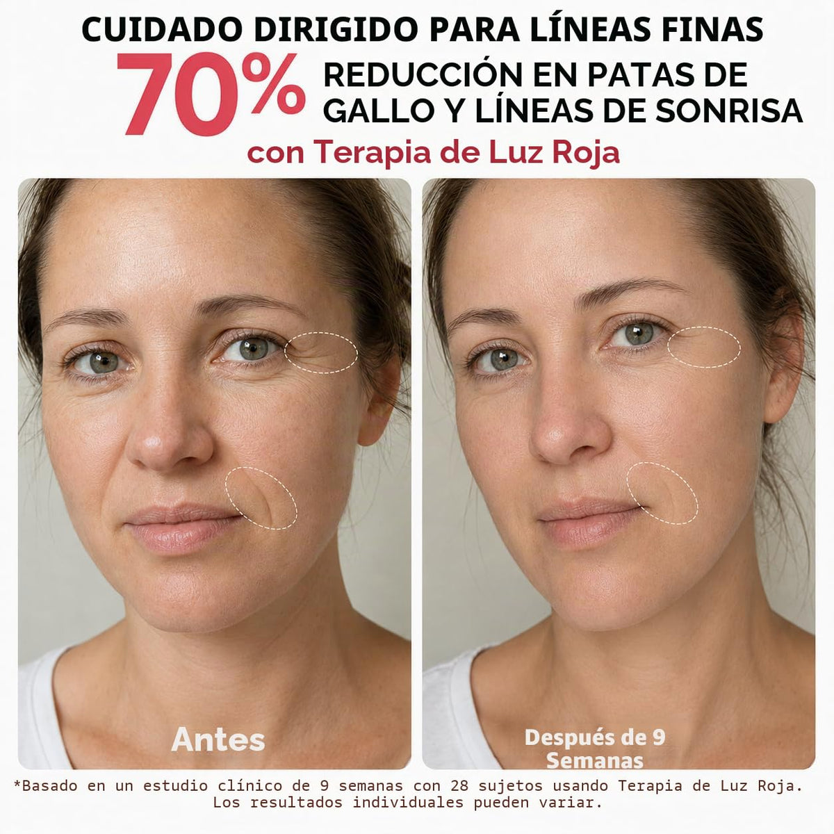 MICEYLIVE Terapia de luz roja para cara, máscara de luz azul aproba...
