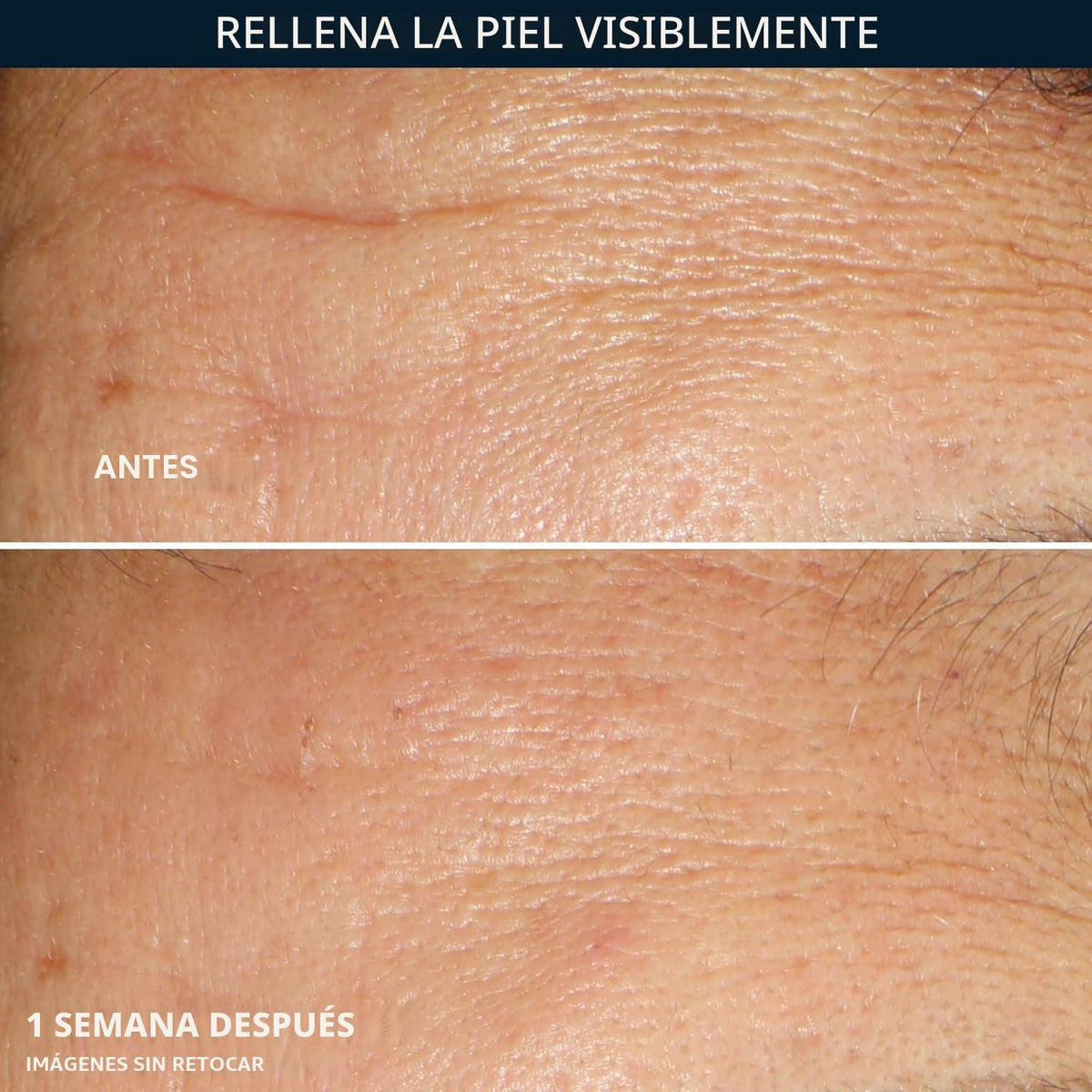 Cápsulas de suero nocturno de ácido hialurónico RoC 30 ct + Cápsula...