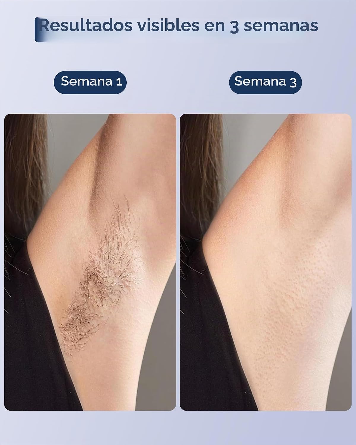 Depilación láser IPL para mujeres y hombres, zafiro, enfriamiento d...