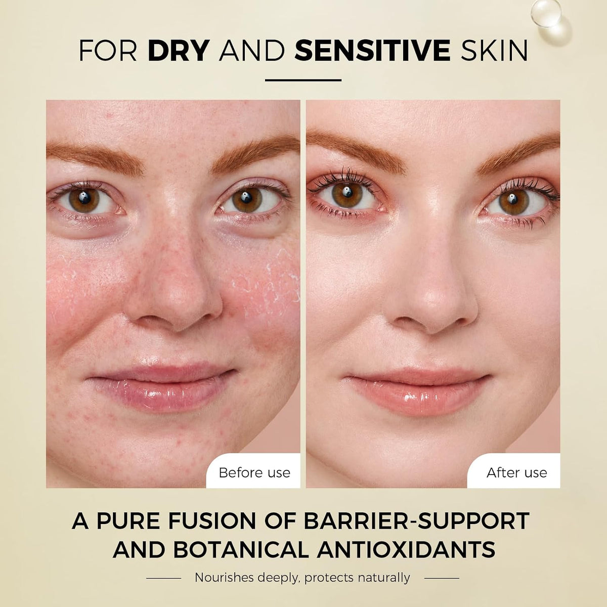 OUKYA Suero de escualano 100% derivado de plantas para rostro, 35 m...