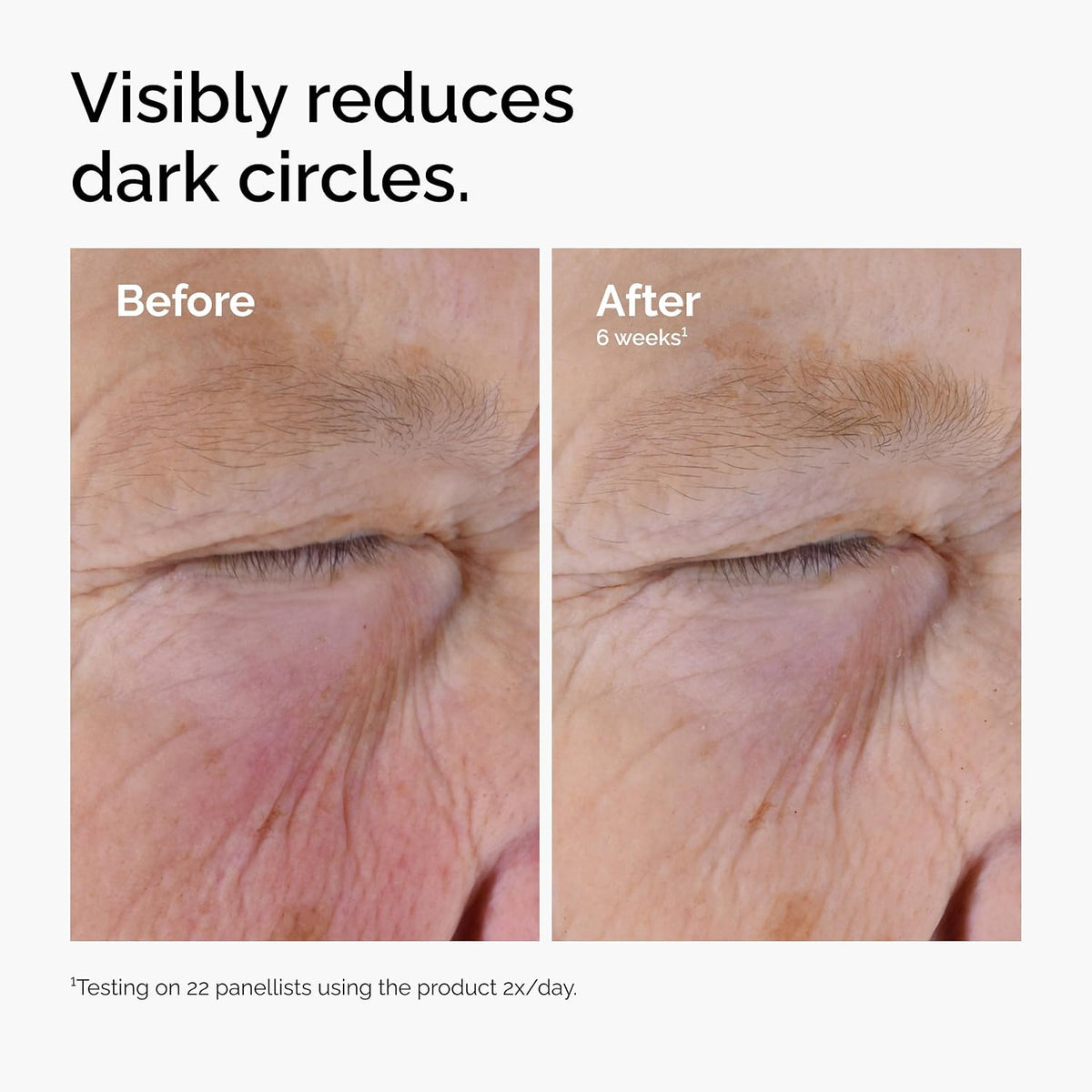 The Ordinary Caffeine Solution 5% + EGCG Eye Serum, suero desinflam...