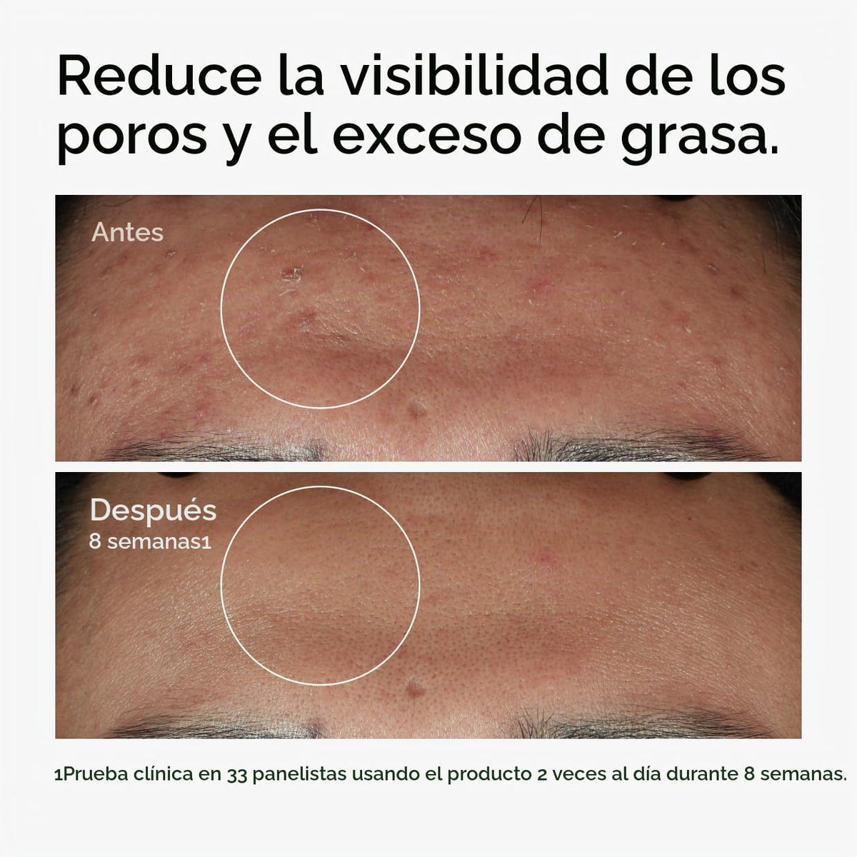 The Ordinary Niacinamida 10% + Zinc 1%, sérum suavizante para piele...