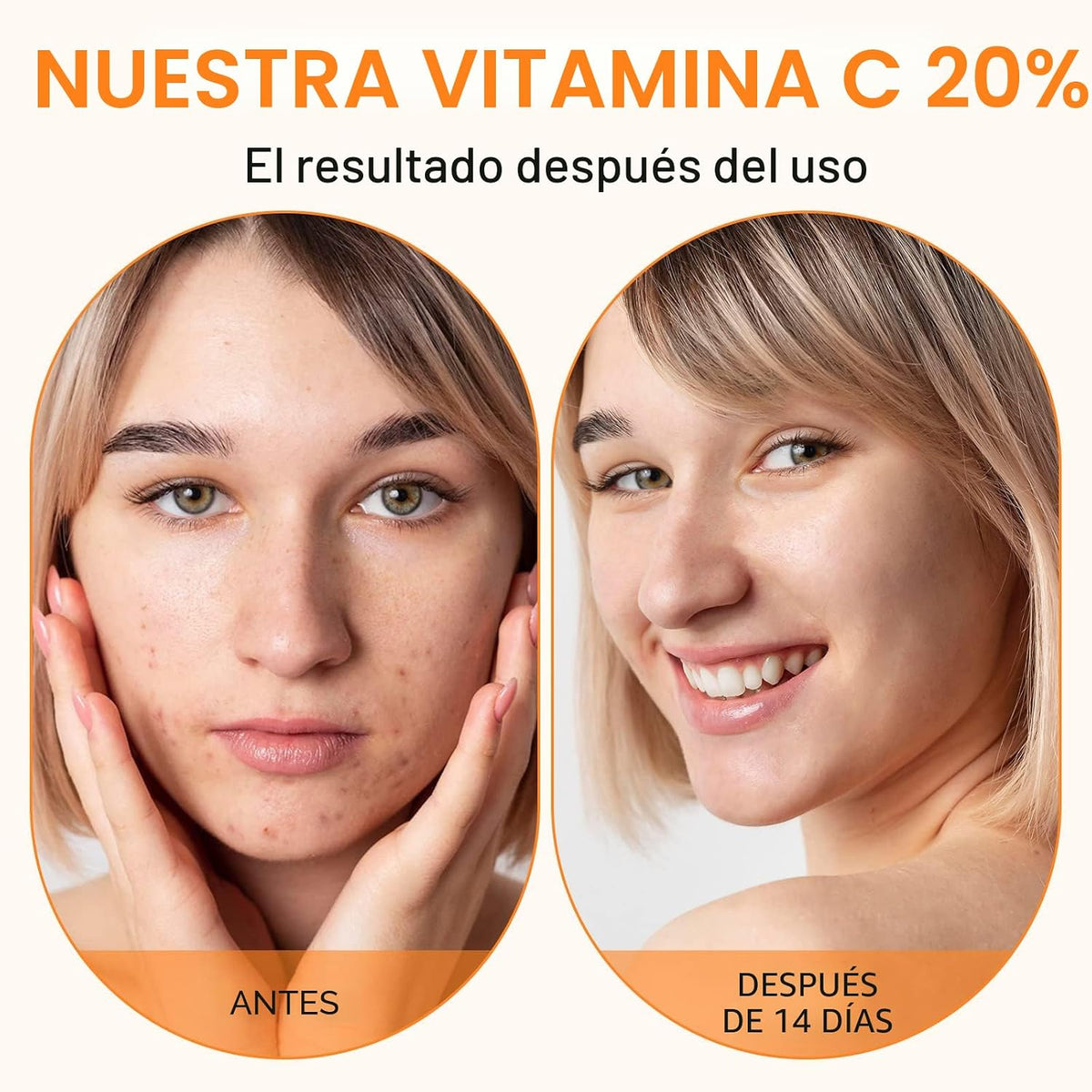 Suero Premium de 20% de Vitamina C para Rostro con Ácido Hialurónic...