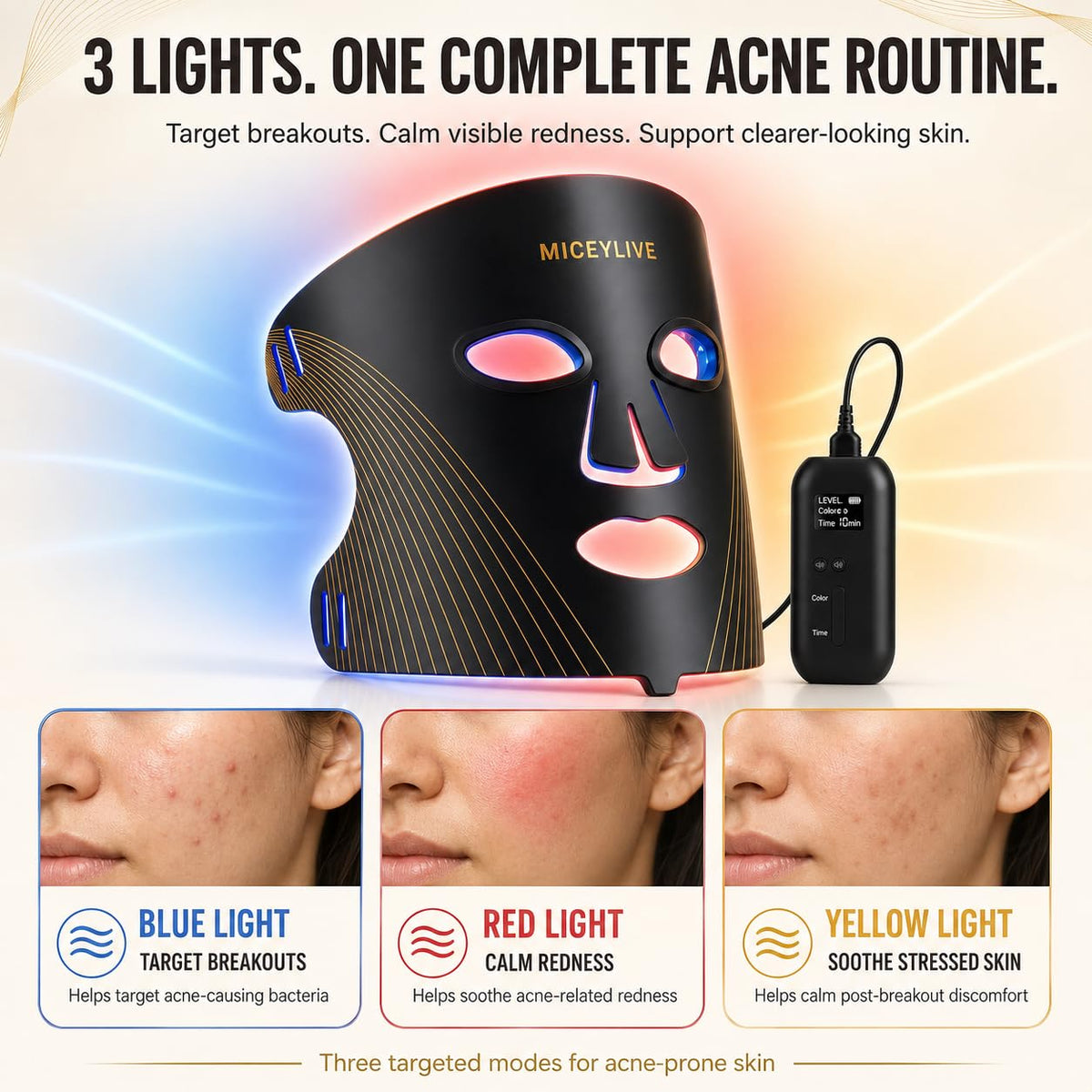 Terapia de luz azul aprobada por la FDA para el acné con inflamació...