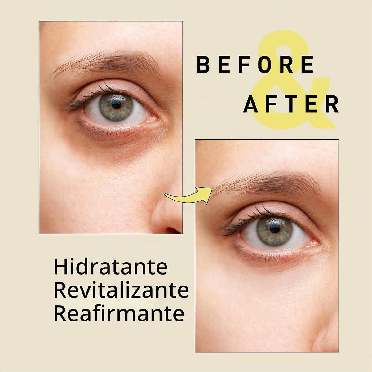 Parches para debajo de los ojos para ojeras: máscaras de gel de muc...