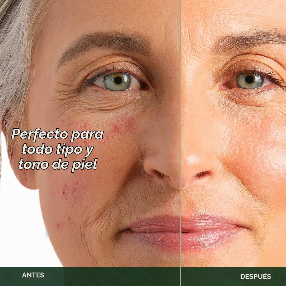 Suero de Vitamin C para cara con ácido hialurónico, anti envejecimi...