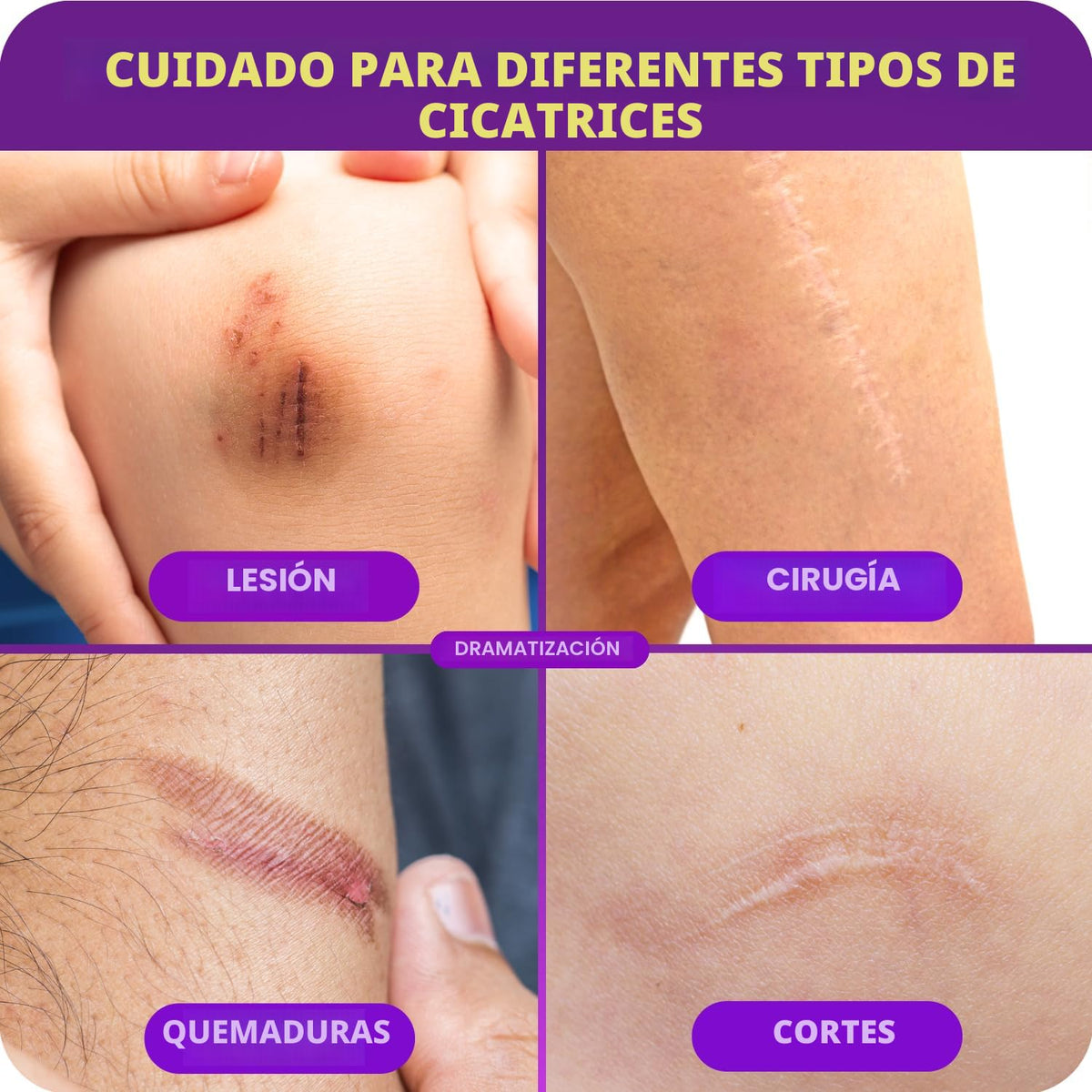 Cicatricure Gel avanzado para cicatrices para niños, aroma a uva, 1...