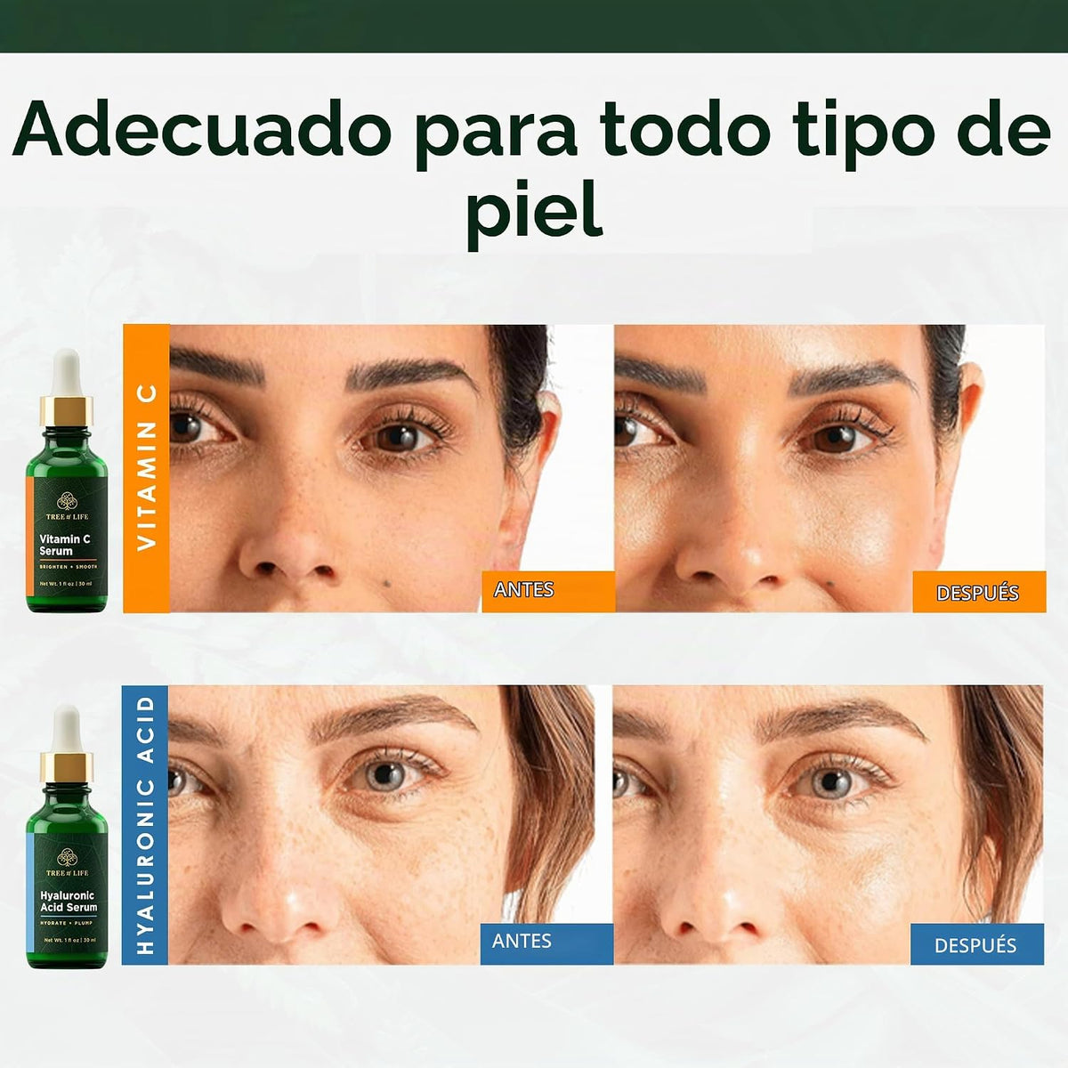 Tree of Life Suero facial para el cuidado de la piel, suero facial...