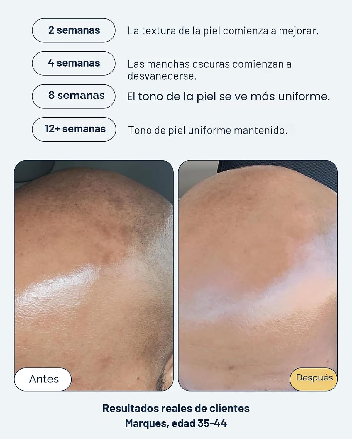 Dúo de suero para defensa diaria y manchas oscuras Remedy Vitamin C...