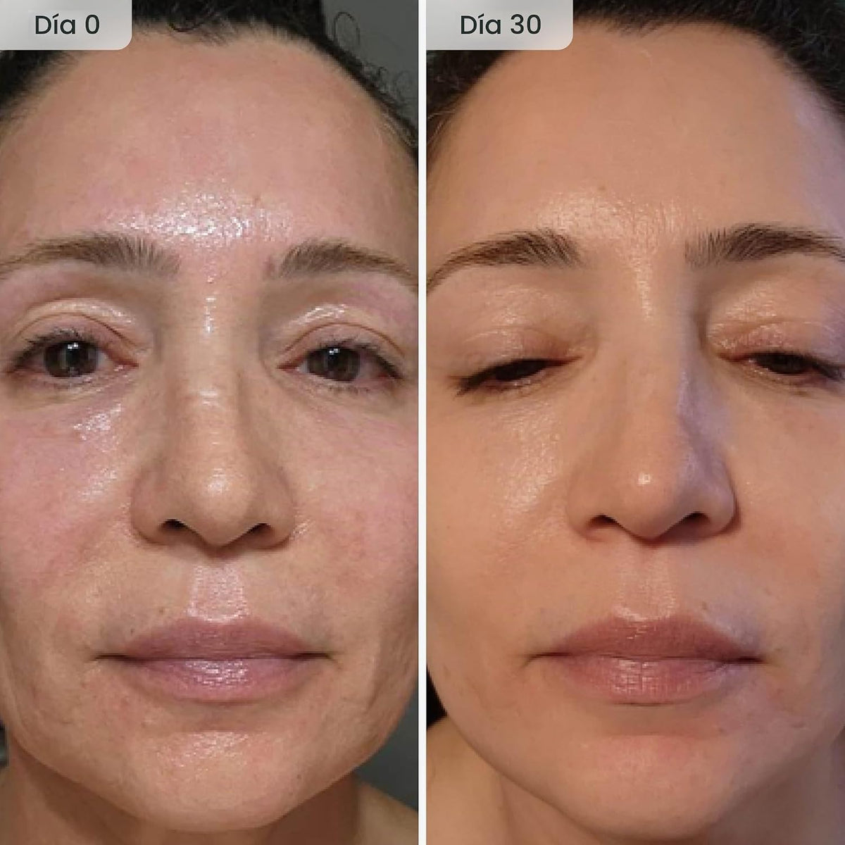 Qure Sistema de microinfusión para la cara, fórmula azul para todo...
