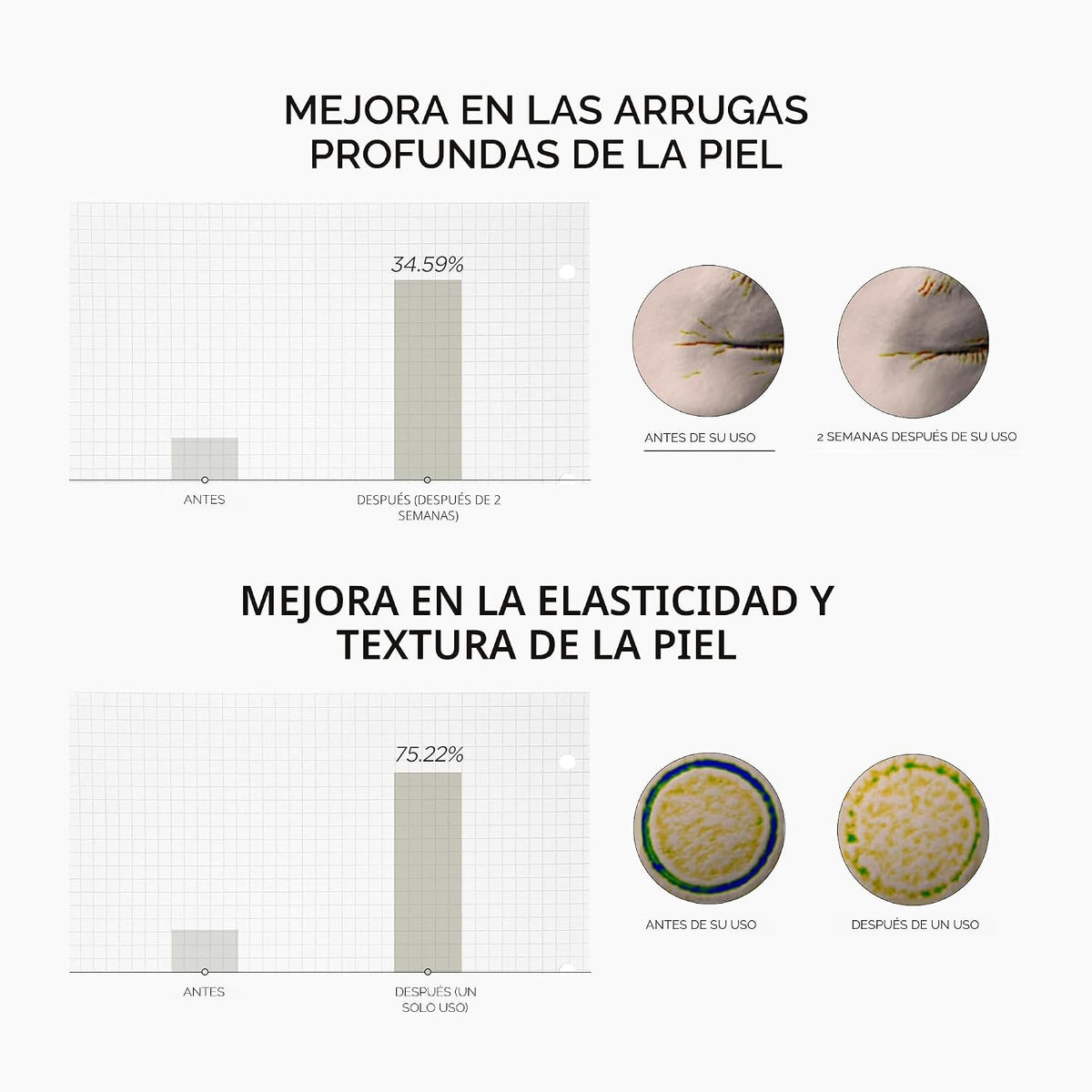 SKIN1004 Retinol 0.2% Boosting Shot Ampolla, suero facial para elas...