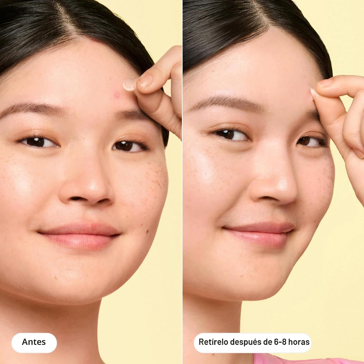 Hero Cosmetics Mighty Patch Mini Invisible+ Parches para espinillas...
