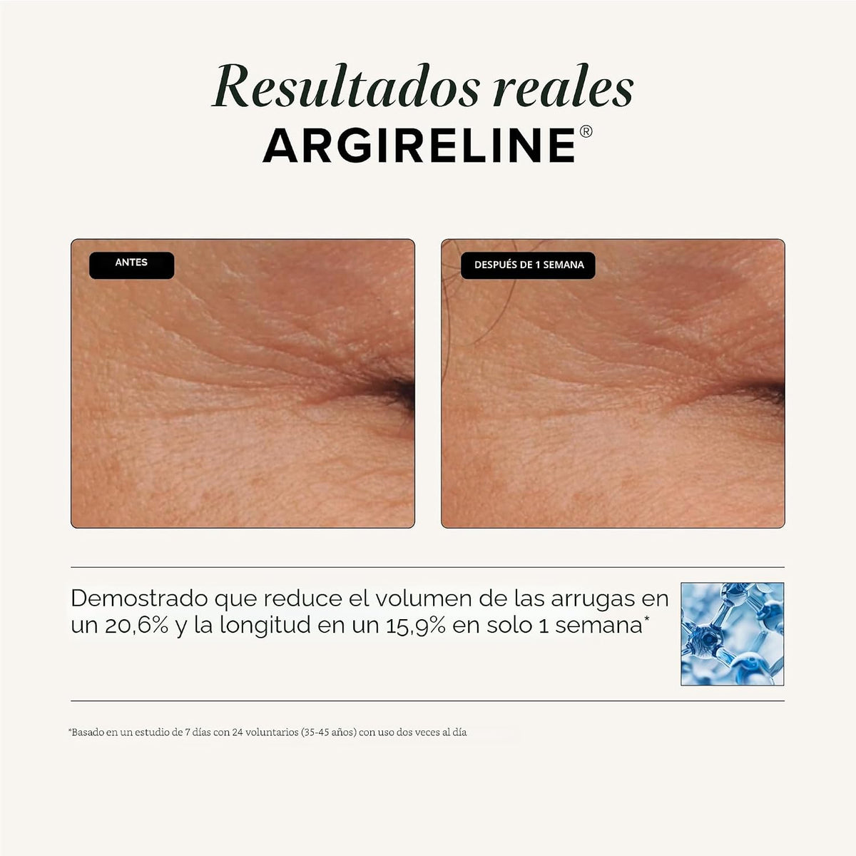 Suero peptídico triple reparación Asterwood, Matrixyl 3000, Argirel...