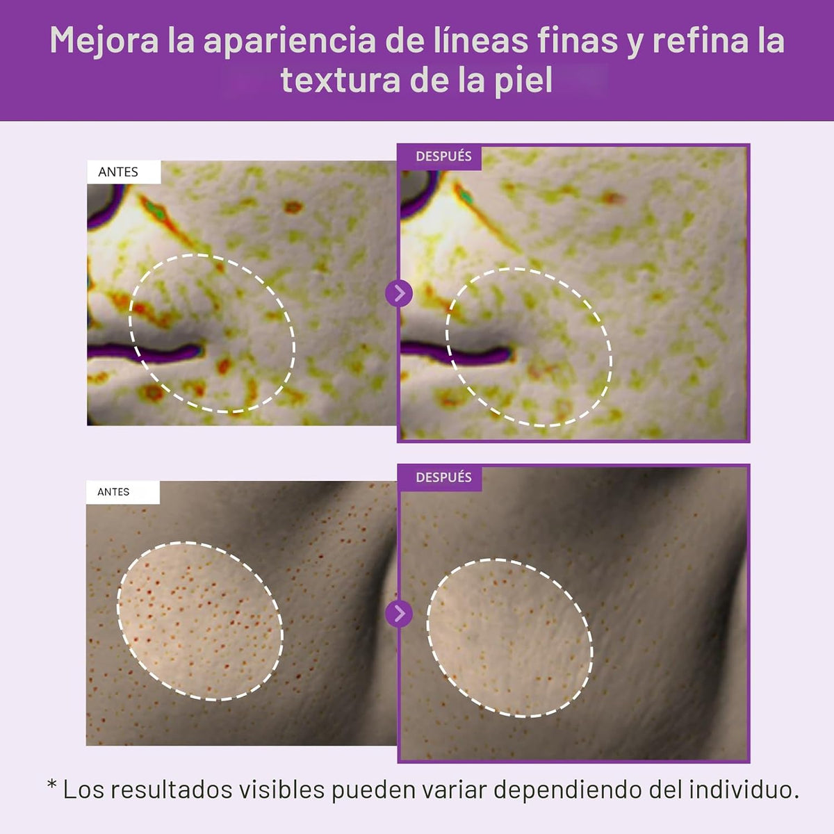 TOSOWOONG Crema de noche con retinol real antienvejecimiento Power...