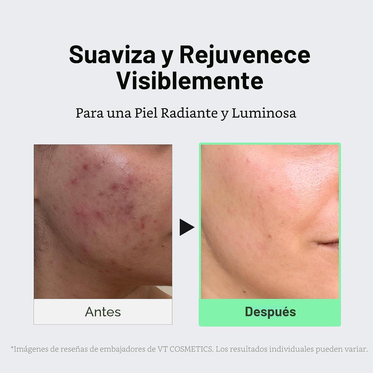 VT COSMETICS CICA Reedle Shot 100 Suero de microagujas | Espícula,...