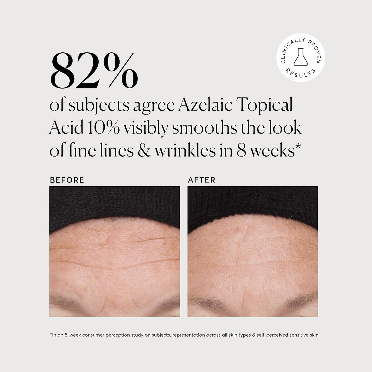 Naturium Ácido Azelaico Tópico 10%, tratamiento de belleza para el...