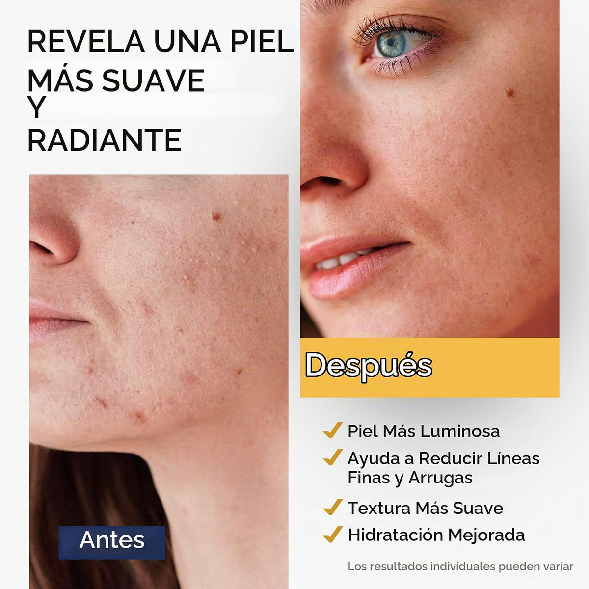 Ember Cloud Suero de vitamina C para rostro con células madre y áci...