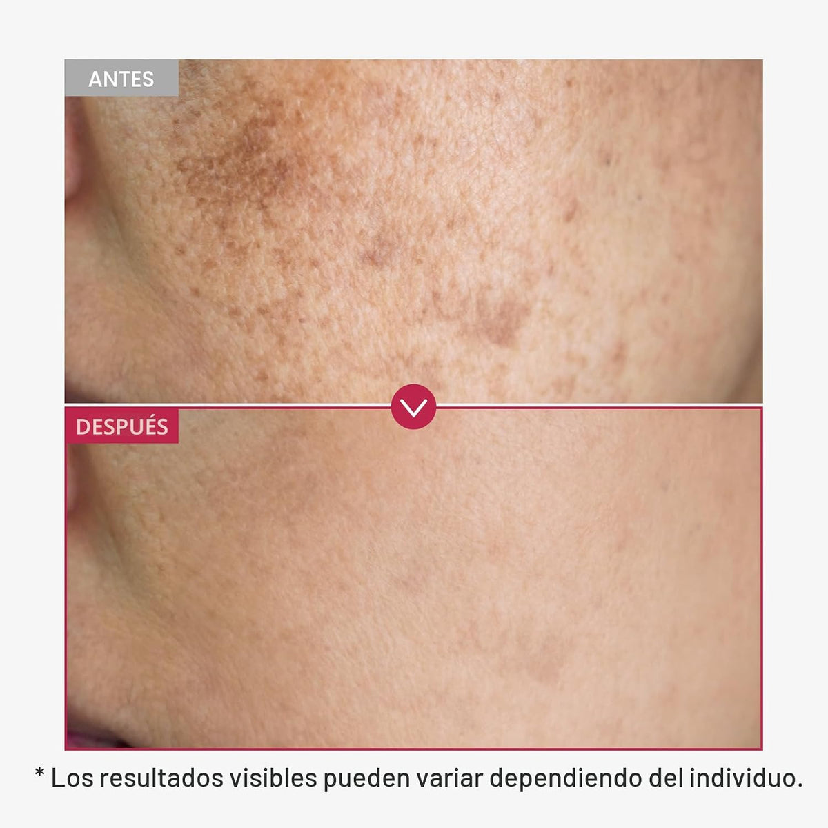 TOSOWOONG Ultimate Clear Glass Skin Serum Duo: Péptido rosa 12 PDRN...