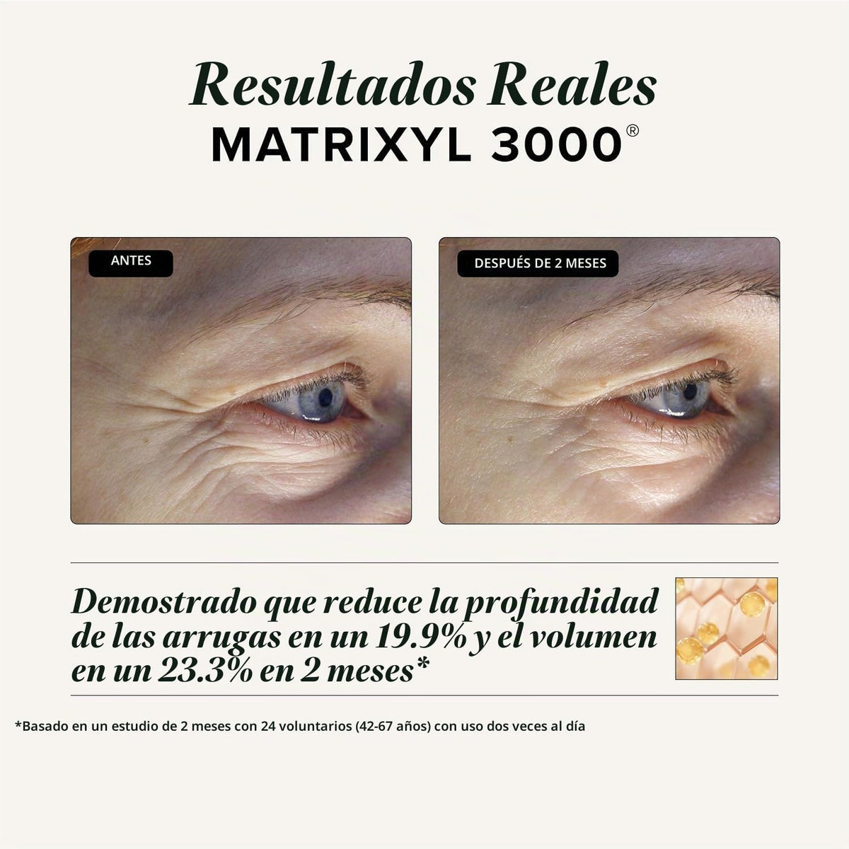 Suero peptídico triple reparación Asterwood, Matrixyl 3000, Argirel...
