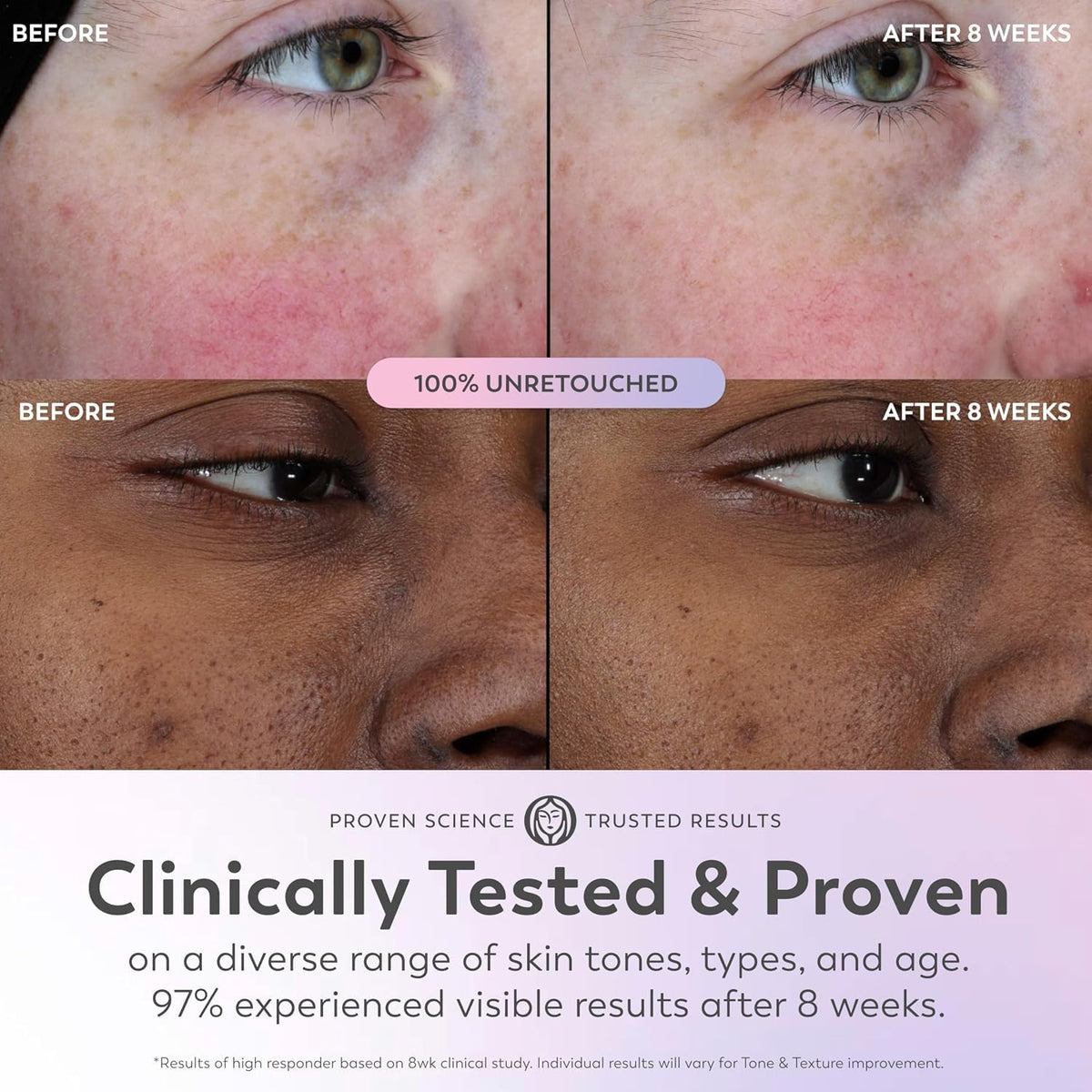 Olay Super Serum - Suero brillante para la cara, niacinamida activa...