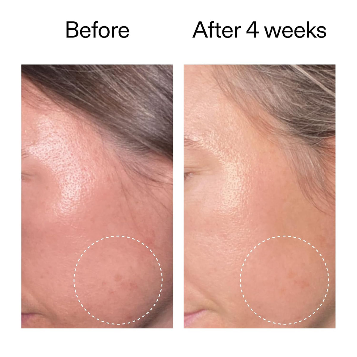 The INKEY List Suero avanzado de retinol al 0,2 % 0,5 fl oz | Retin...