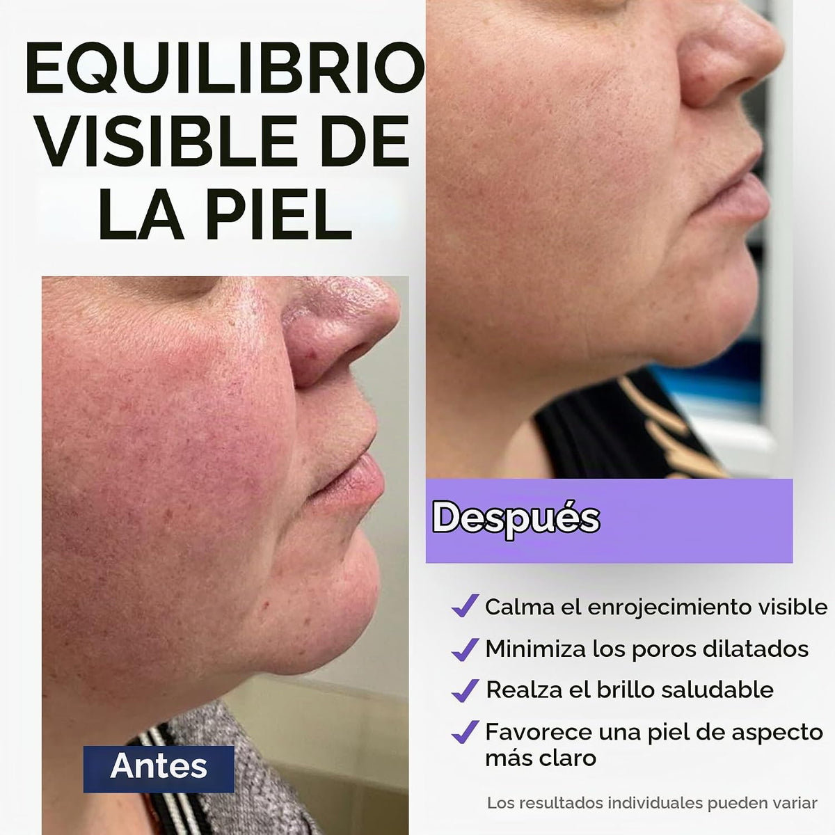 Ember Cloud Suero de niacinamida para rostro 10% con zinc 1% vitami...