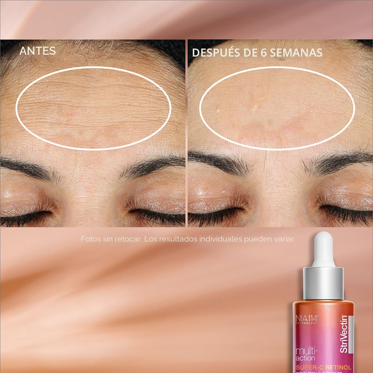 StriVectin Multi Action Super C Retinol Suero Iluminador y Corrector