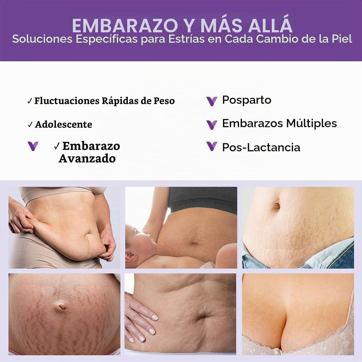 VIGORITY Body Balance Duo - Crema para estrías + crema de apoyo de...