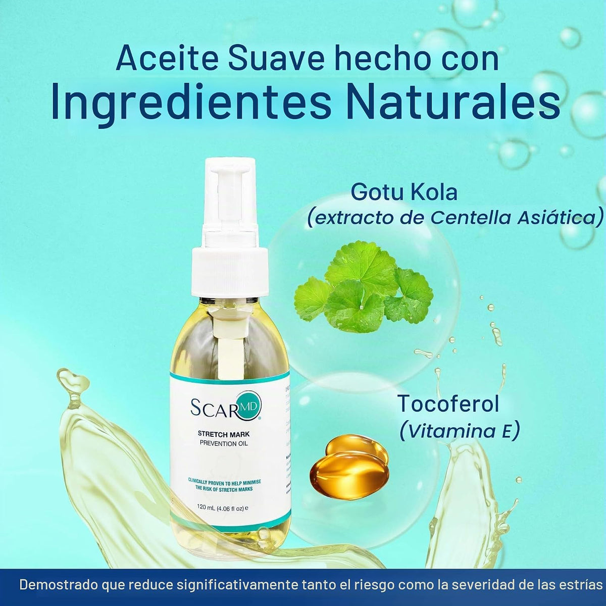 Aceite de estrías, minimiza el riesgo y la gravedad de las estrías,...