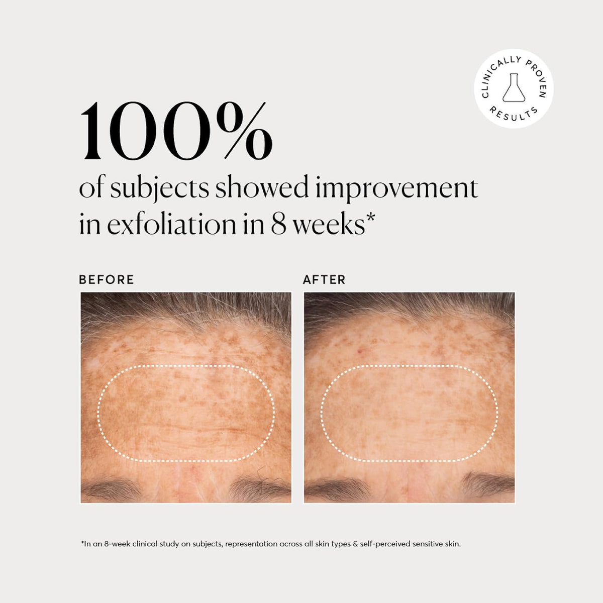 Naturium BHA Exfoliante Líquido 2%, Tratamiento Exfoliante de Poros...