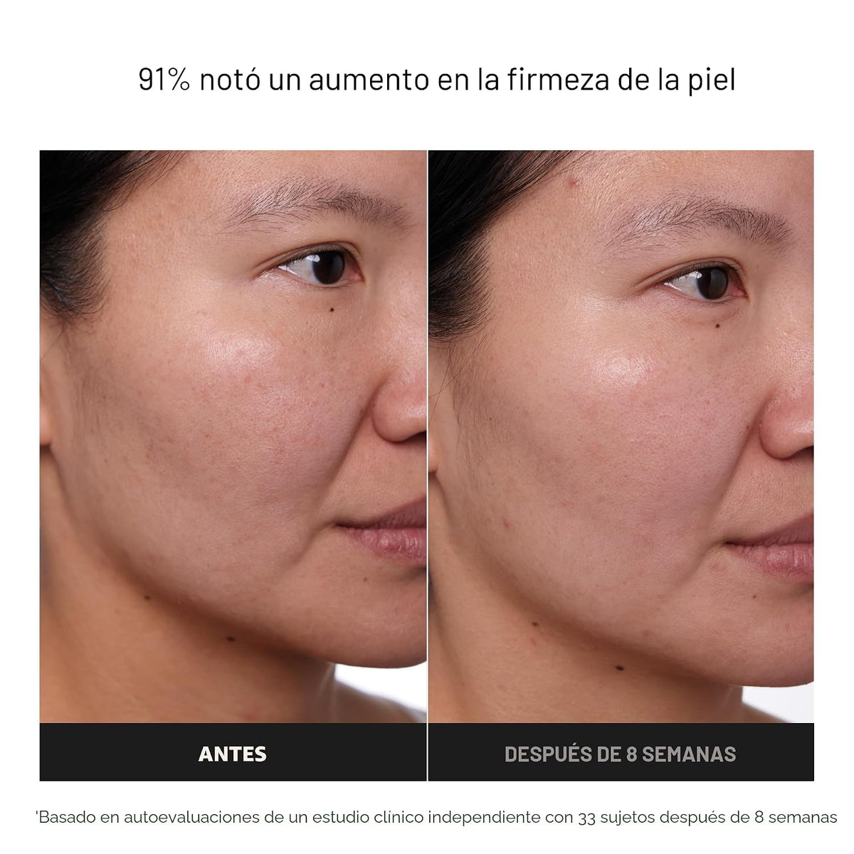 Paula's Choice CLÍNICA 1% Retinol Crema Tratamiento | Suero facial...