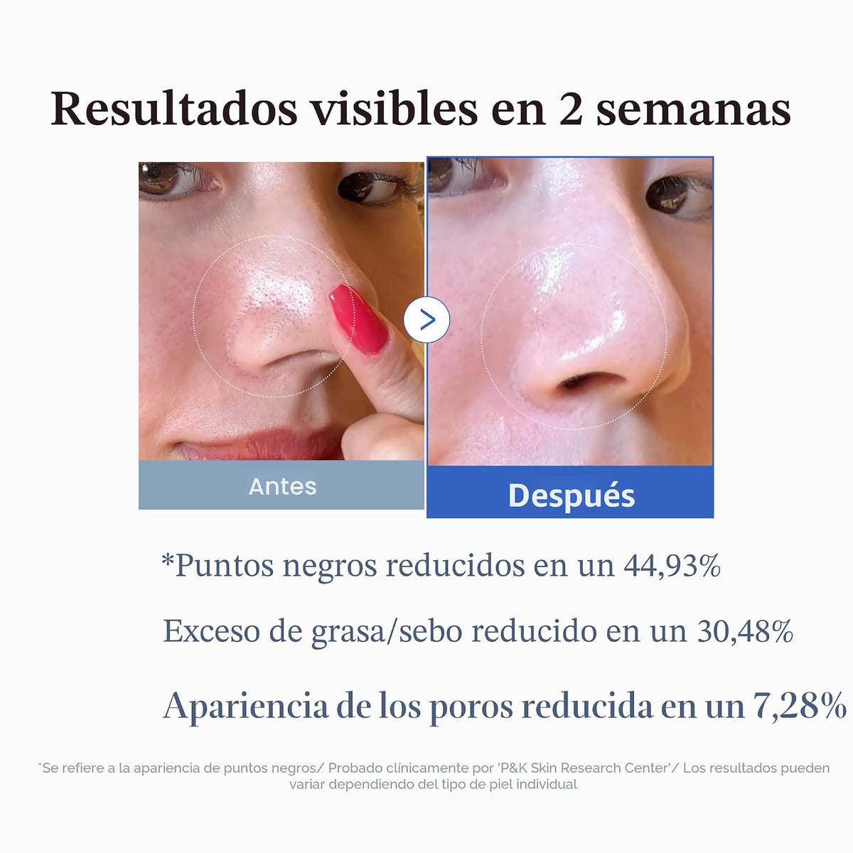 medicube Dúo de cuidado de poros para una piel impecable: aceite li...