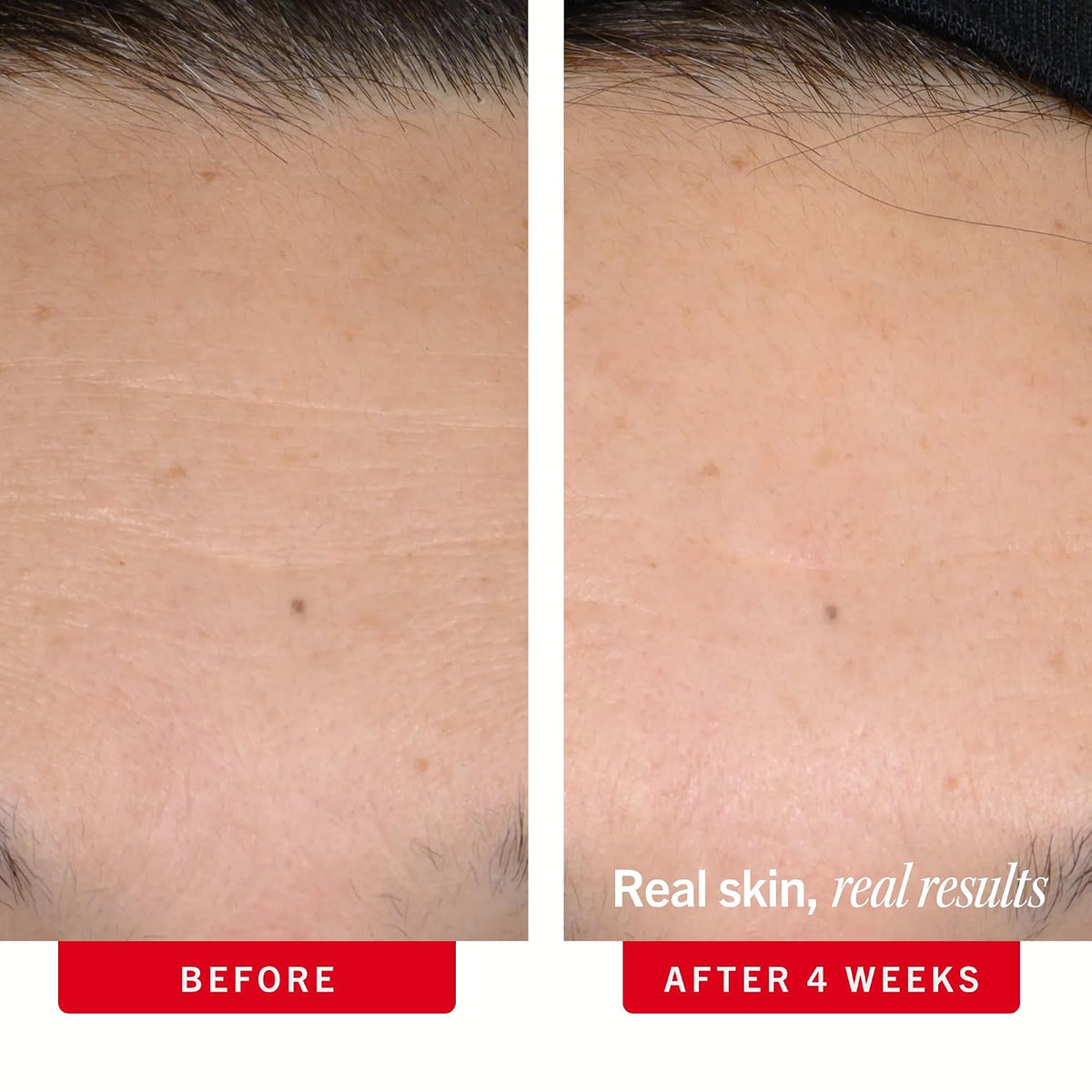 Suero de retinol ultra reparador First Aid Beauty con complejo de r...